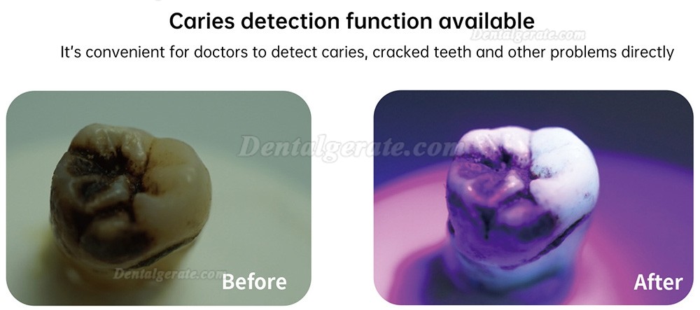 Mecco Q9 Kabellose LED-Polymerisationslampe Dental mit integriertem Lichtmesser und Kariesdetektor